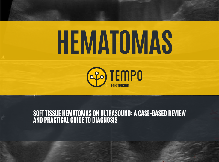 hematomas-y-ecografia